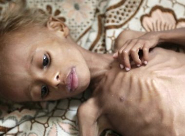 Hundreds of thousands Yemeni children face starvation 5