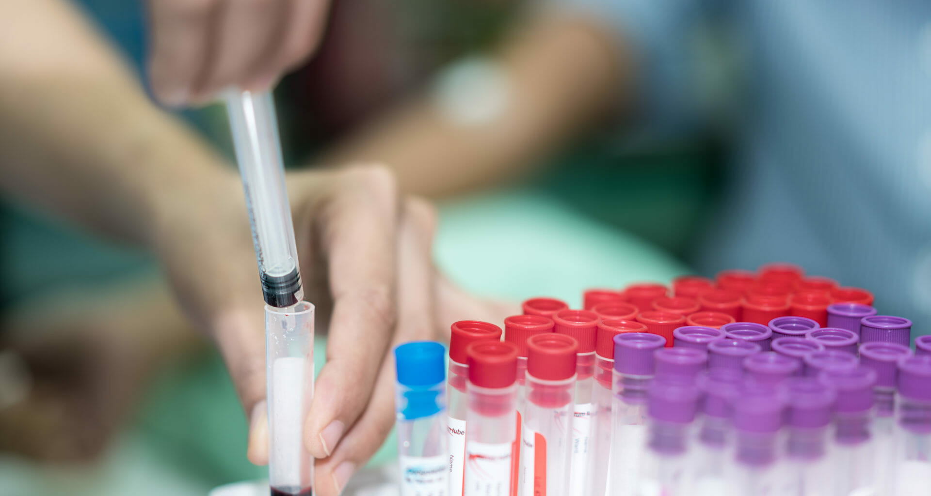 'Severe' drop in HIV testing during lockdown could 'reverse progress', study warns 3