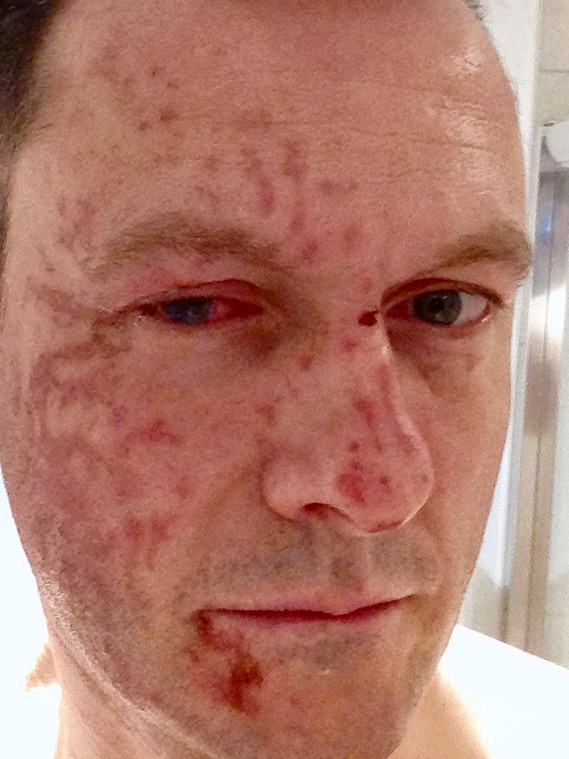 Acid attack journalist accuses Crown Office of "dirty deal" with wife beater 8
